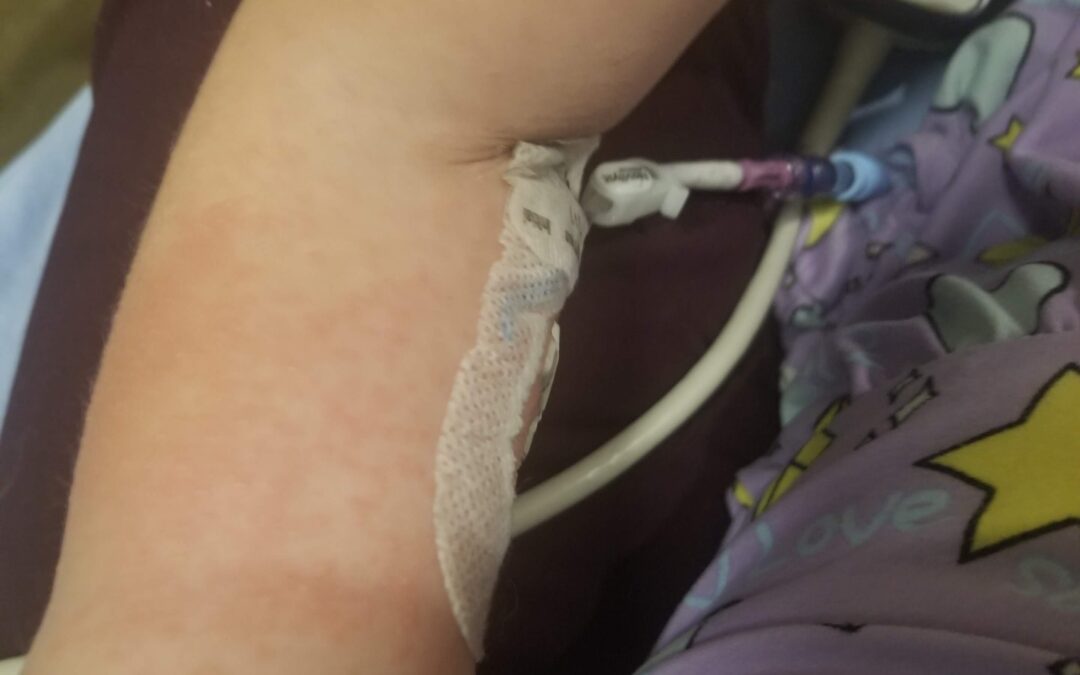 PICC Line Pros and Cons